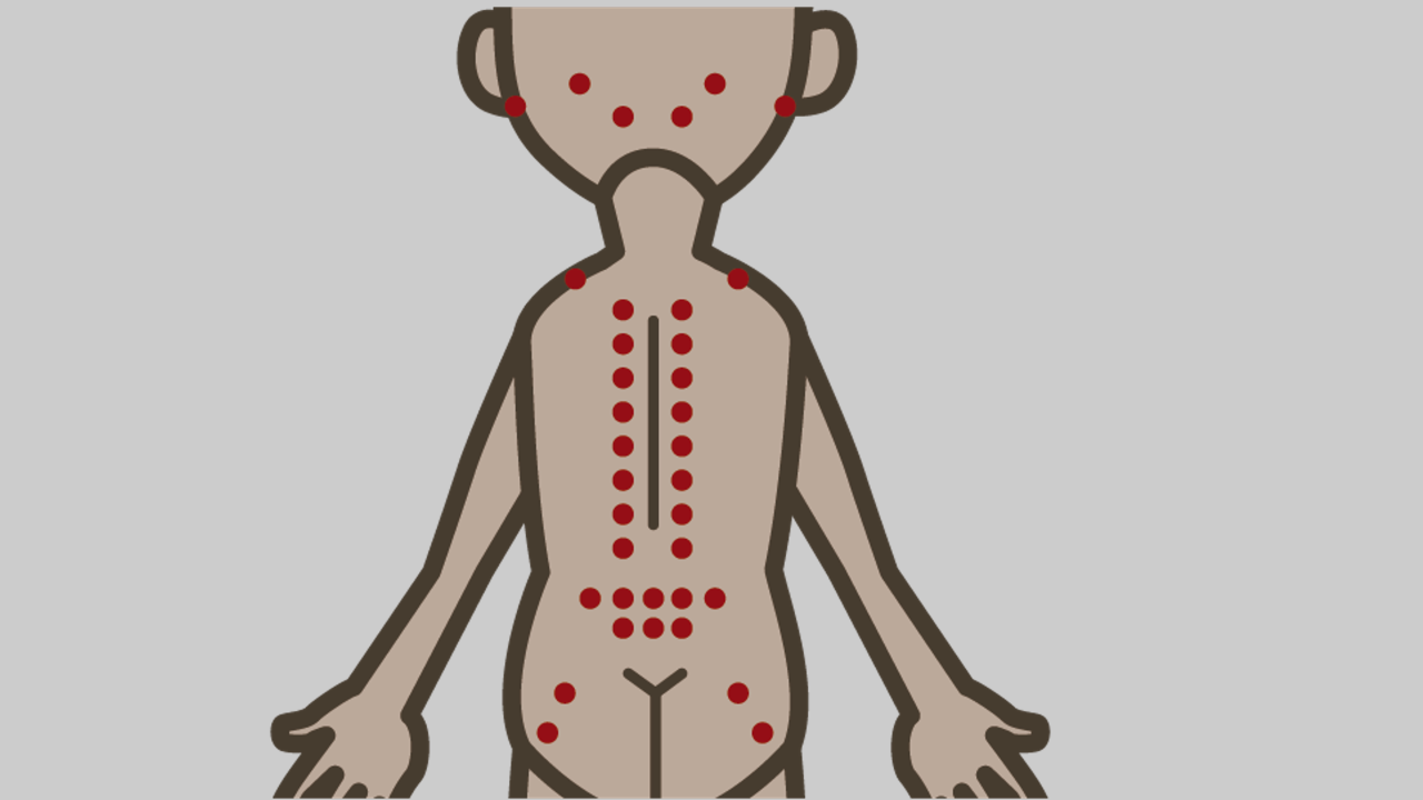 慢性腰痛のツボ 気になる 人体のツボに関して 新宿で評判の整体院